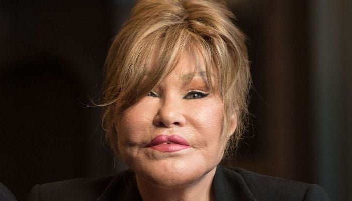 The shocking truth behind Jocelyn Wildensteins unexpected passinf revealed